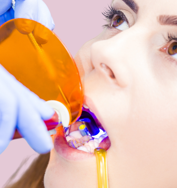 dental fillings & restorations